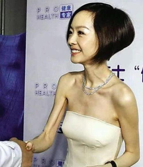 明星谁减肥狠,揭秘谁减肥最狠